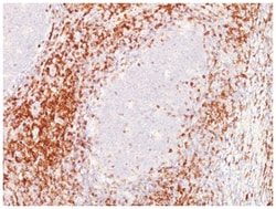 CD6 Antibody (C6/372), Novus Biologicals 0.02mg; Unlabeled:Antibodies,