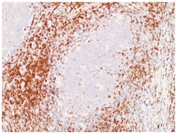 CD6 Antibody (SPM547), Novus Biologicals:Antibodies:Primary Antibodies
