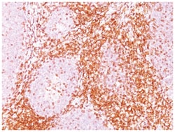 CD6 Antibody (C6/372+3F7B5), Novus Biologicals:Antibodies:Primary Antibodies