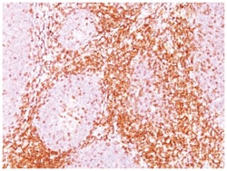 CD6 Antibody (SPM547), Novus Biologicals:Antibodies:Primary Antibodies