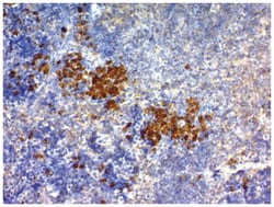 CD63 Antibody (SPM524), Novus Biologicals:Antibodies:Primary Antibodies