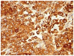 CD63 Antibody (SPM524), Novus Biologicals:Antibodies:Primary Antibodies
