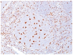 CD68/SR-D1 Mouse, Clone: C68/684, Novus Biologicals 0.2mg; Unlabeled:Antibodies,