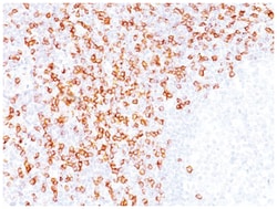 CD8 Antibody (C8/468 + C8/144B), Novus Biologicals 0.02mg; Unlabeled:Antibodies,