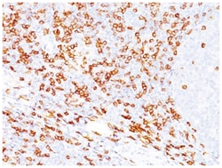 CD8 Antibody (C8/468), Novus Biologicals:Antibodies:Primary Antibodies