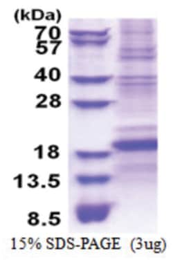 Novus Biologicals&trade;&nbsp;Recombinant Human CD8 beta His Protein