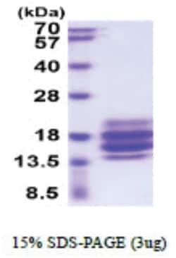 Novus Biologicals Recombinant Human CD90/Thy1 His Protein 0.02 mg | Buy Online | Novus Biologicals&trade; | Fisher Scientific