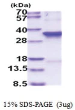Novus Biologicals&trade;&nbsp;Recombinant Human CDC2/CDK1 His Protein