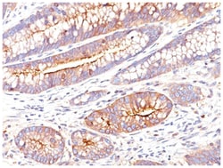 CEA Mouse, Clone: C66/261, Novus Biologicals:Antibodies:Primary Antibodies