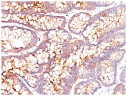 CEA Mouse, Clone: SPM541, Novus Biologicals 0.2mg; Unlabeled:Antibodies,