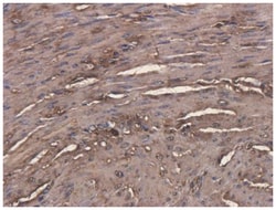 CEACAM5/CD66e Antibody (Arcitumomab) - Chimeric - Azide and BSA Free, Novus