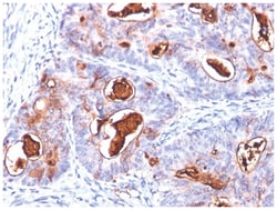 CEACAM5/CD66e Antibody (COL-1 + CEA31 + C66/261), Novus Biologicals 0.02mg;