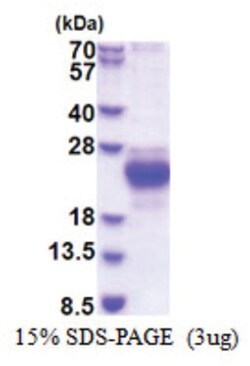 Novus Biologicals&trade;&nbsp;Recombinant Human CHAC2 His Protein