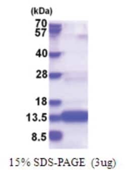 Novus Biologicals Recombinant Human CHCHD8 His Protein 0.25 mg | Buy Online | Novus Biologicals&trade; | Fisher Scientific