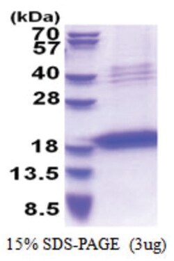 Novus Biologicals Recombinant Human Chondromodulin-1/LECT1 His Protein 0.1 mg | Buy Online | Novus Biologicals&trade; | Fisher Scientific