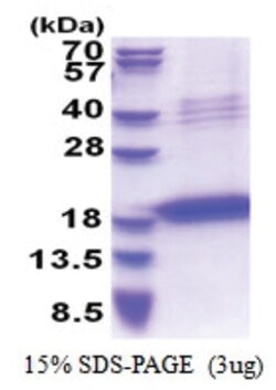 Novus Biologicals Recombinant Human Chondromodulin-1/LECT1 His Protein 0.1 mg | Buy Online | Novus Biologicals&trade; | Fisher Scientific