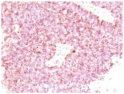 Chromogranin A Mouse, Clone: LK2H10 + PHE5 + CGA/414, Novus Biologicals