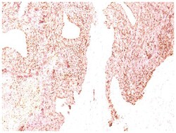 Chromogranin A Mouse, Clone: SPM339, Novus Biologicals:Antibodies:Primary
