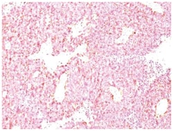 Chromogranin A Mouse, Clone: LK2H10 + PHE5, Novus Biologicals 0.02mg; Unlabeled:Antibodies,