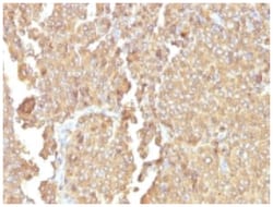 Chromogranin A Mouse, Clone: LK2H10 + PHE5, Novus Biologicals 0.02mg; Unlabeled:Antibodies,