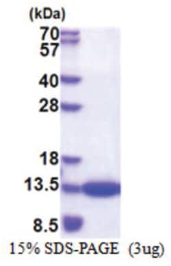 Novus Biologicals&trade;&nbsp;Recombinant Human CKS1 His Protein