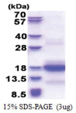 Novus Biologicals&trade;&nbsp;Recombinant Human CNPY1 His Protein
