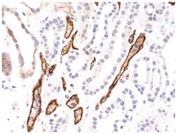 Complement C4d Antibody (C4D204), Novus Biologicals 0.2mg; Unlabeled:Antibodies,