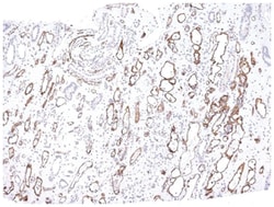 Complement C4d Antibody (C4D204), Novus Biologicals 0.2mg; Unlabeled:Antibodies,