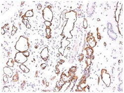 Complement C4d Antibody (C4D204), Novus Biologicals 0.2mg; Unlabeled:Antibodies,
