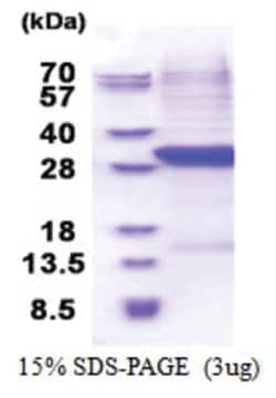 Novus Biologicals Recombinant Human Complement Factor B His Protein 0.1 mg | Buy Online | Novus Biologicals&trade; | Fisher Scientific