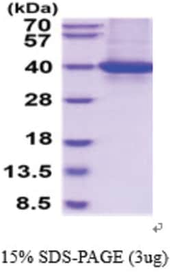 Novus Biologicals Recombinant Human CRALBP His Protein 0.05 mg | Buy Online | Novus Biologicals&trade; | Fisher Scientific