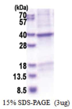 Novus Biologicals&trade;&nbsp;Recombinant Human CRHBP His Protein