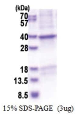 Novus Biologicals Recombinant Human CRHBP His Protein 0.5 mg | Buy Online | Novus Biologicals&trade; | Fisher Scientific