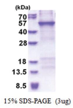 Novus Biologicals&trade;&nbsp;Recombinant Human CRTAP His Protein