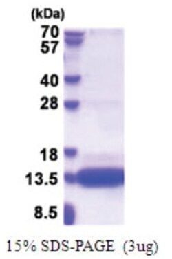 Novus Biologicals&trade;&nbsp;Recombinant Human CSAG1 His Protein