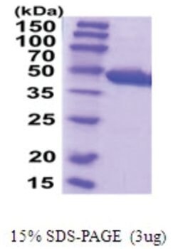 Novus Biologicals&trade;&nbsp;Recombinant Human Cysteine Conjugate beta-Lyase/CCBL1 His Protein