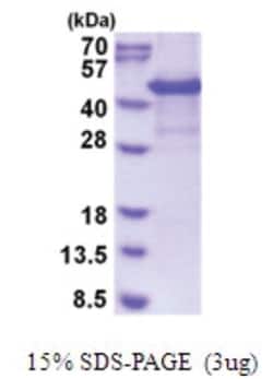 Novus Biologicals Recombinant Human CYTIP His Protein 0.5 mg | Buy Online | Novus Biologicals&trade; | Fisher Scientific