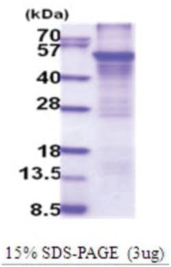 Novus Biologicals&trade;&nbsp;Recombinant Human Cytochrome P450 2E1 His Protein