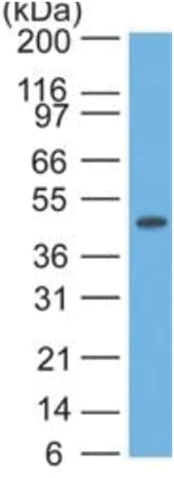 Cytokeratin 17 Mouse, Clone: SPM560, Novus Biologicals:Antibodies:Primary