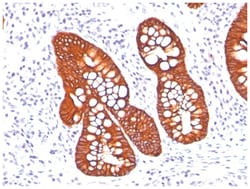 Cytokeratin 19 Antibody (A53-B/A2.26 + BA17), Novus Biologicals 0.1mg;