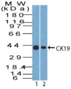 Cytokeratin 19 Antibody (SPM266), Novus Biologicals 0.02mg; Unlabeled:Antibodies,