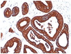Cytokeratin 19 Mouse, Clone: SPM561, Novus Biologicals:Antibodies:Primary