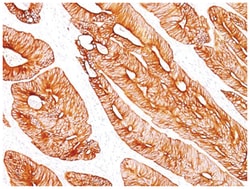 Cytokeratin 8 Antibody (K8/383), Novus Biologicals:Antibodies:Primary Antibodies