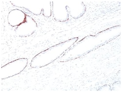 Cytokeratin, HMW Mouse, Clone: 34BE12, Novus Biologicals:Antibodies:Primary