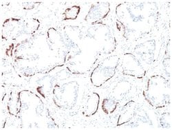 Cytokeratin, HMW Mouse, Clone: 34BE12, Novus Biologicals:Antibodies:Primary