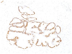 Cytokeratin 14 Mouse, Clone: SPM263, Novus Biologicals 0.2mg; Unlabeled:Antibodies,
