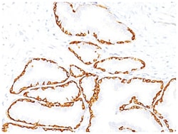 Cytokeratin 14 Mouse, Clone: SPM263, Novus Biologicals 0.2mg; Unlabeled:Antibodies,