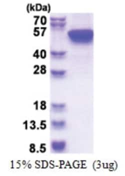 Novus Biologicals&trade;&nbsp;Recombinant Human Cytokeratin 16 His Protein