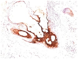 Cytokeratin 17 Mouse, Clone: SPM560, Novus Biologicals:Antibodies:Primary