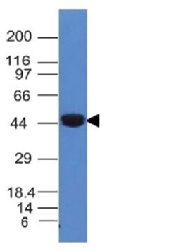 Cytokeratin 8 Antibody (K8/383), Novus Biologicals:Antibodies:Primary Antibodies